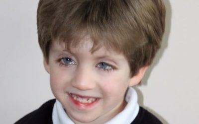 Walking steady. 5 year old with Kabuki Syndrome