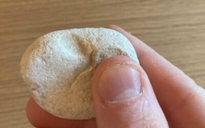 My Story – visual field and regaining joy of hands-on work